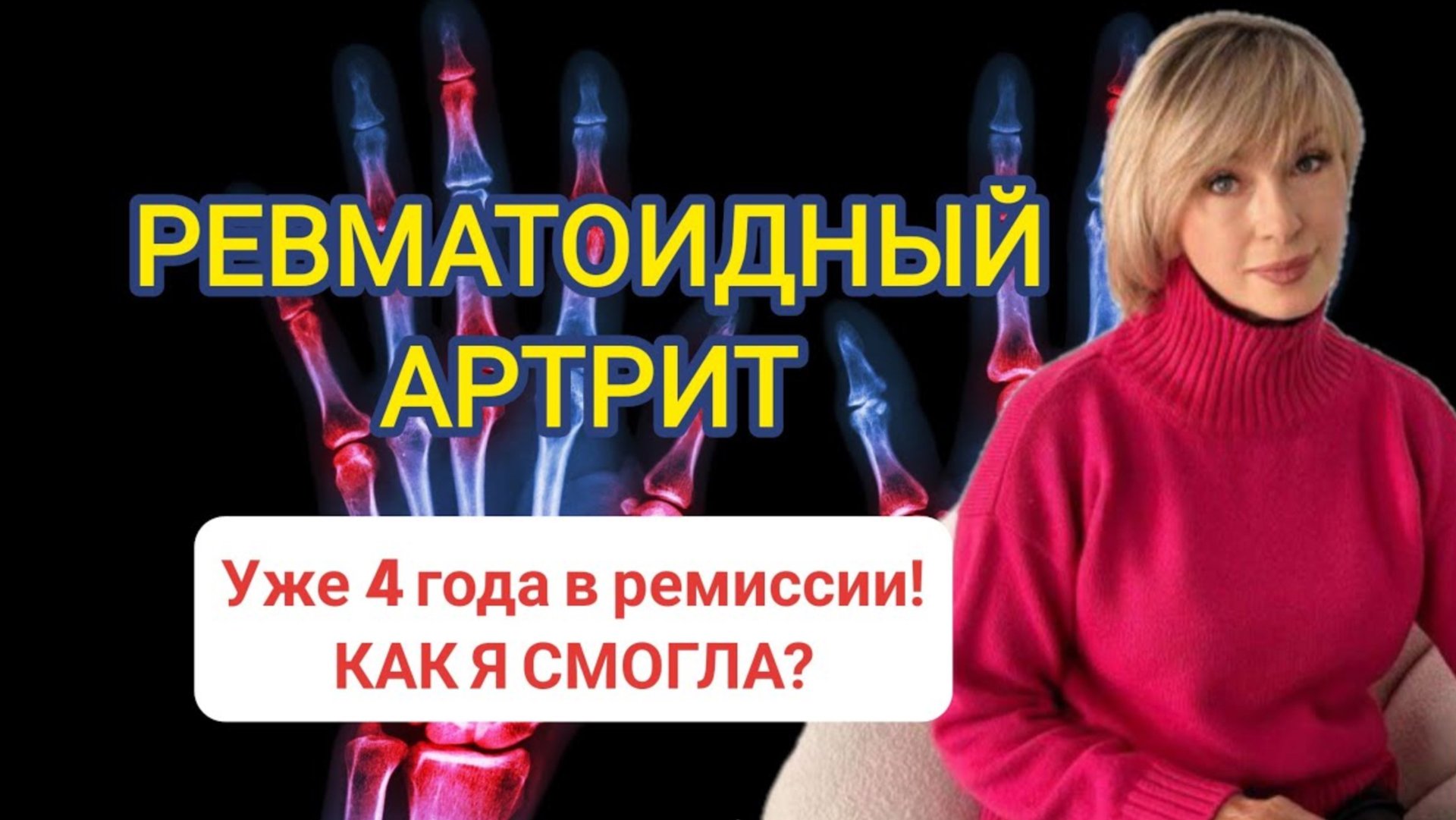 Ревматоидный артрит. Победа ревматоидного артрита. Ремиссия моей клиентки