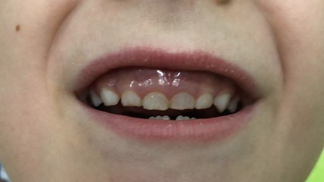 Звук Р.
Второе занятие, постановка от грибка, получилось от ДР
Матвей😊