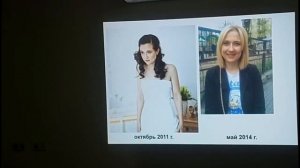 Синдром Кушинга (часть 1): клиническая диагностика