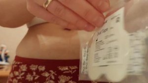 How to Insert Guardian Sensor 3 Into Abdomen