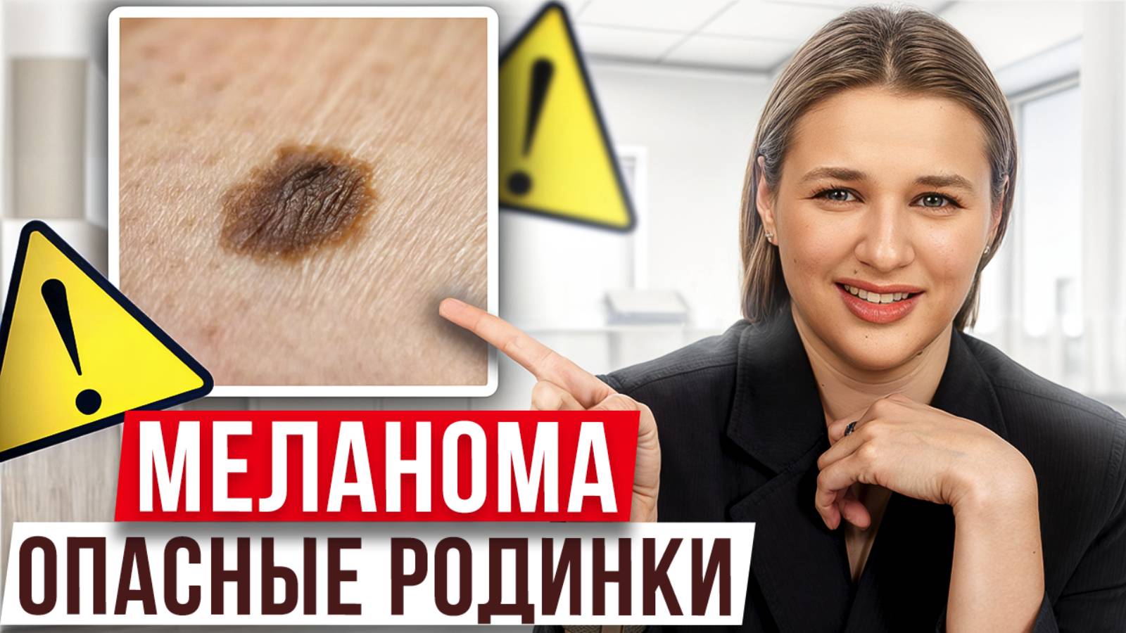 ТАКИЕ родинки могут быть УГРОЗОЙ! / Как распознать ОПАСНЫЕ изменения на коже? смотреть онлайн