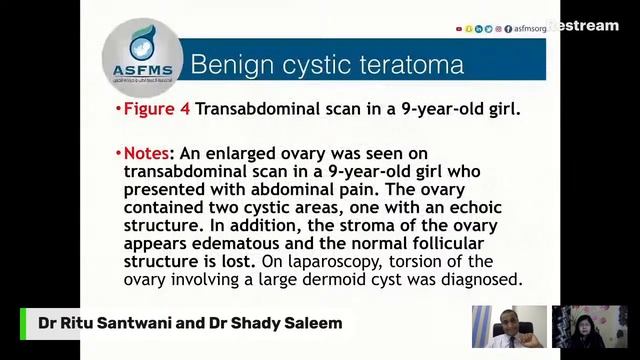 Academic Webinar on #Ultrasound of #Adnexal #mass - Dr Ritu Santwani and Dr Shady Saleem смотреть онлайн