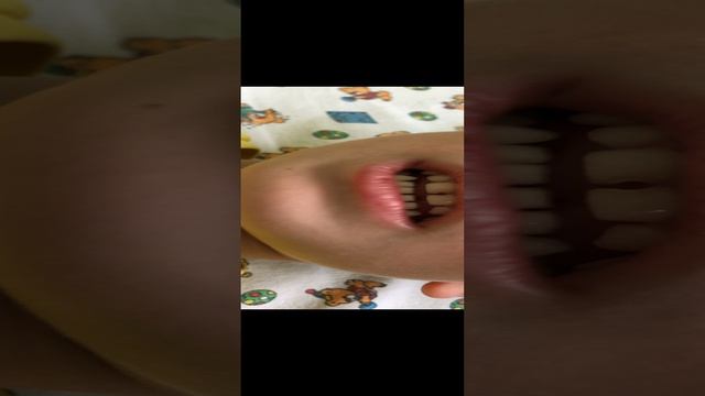 Постановка звука Р.
"Моторчик" уже без механической помощи.
Саша🔥