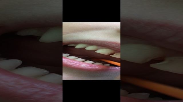 Постановка звука Р.
Заводим "моторчик" с помощью зондозаменителя.
Саша ❤️