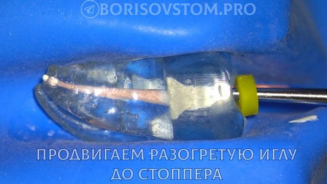 Борисов Александр - вертикальная компакция - пломбировка жидкой гуттаперчей GuttaEst02 и GuttaFill02 смотреть онлайн
