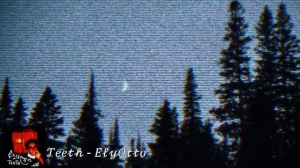 Teeth - ElyOtto (Pitched Down)