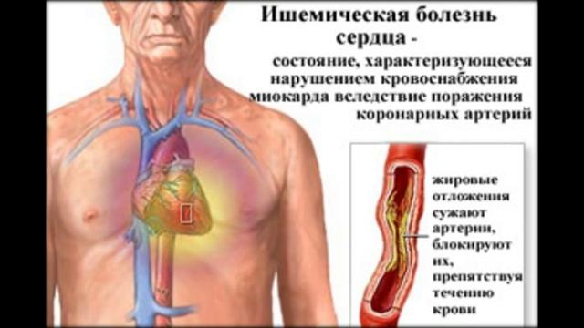 болезни сердца список и симптомы у детей смотреть онлайн