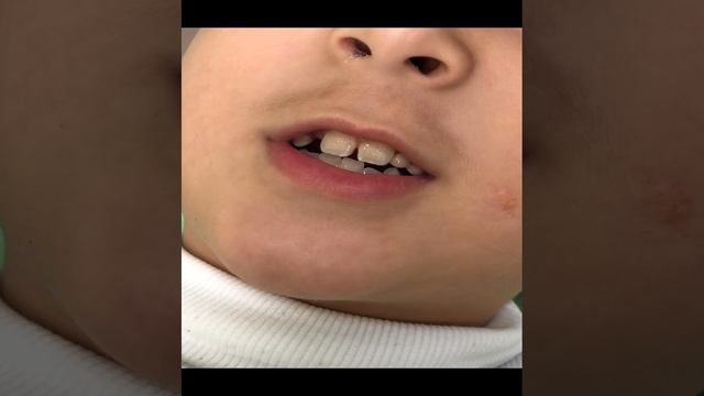 Постановка звука Р.
Пробуем от грибка без механической помощи слоги с ТР.
Батыр❤️