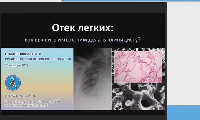 Гипергидратация и отек легких смотреть онлайн
