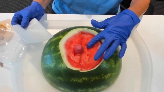 026 RISP: Revise, Isolate, Skin Graft, Pouch смотреть онлайн