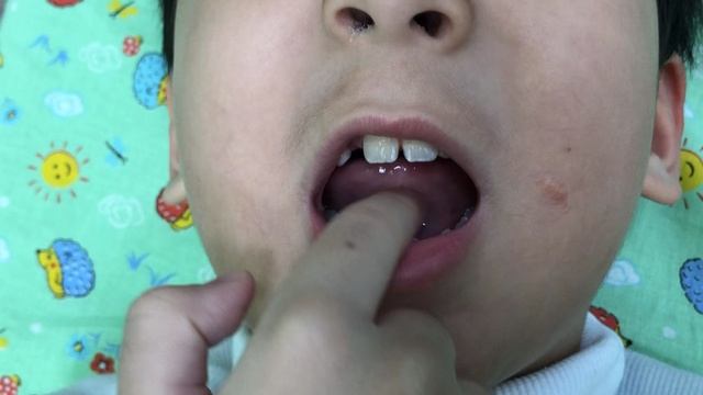 Постановка звука Р с механической помощью.
Батыр)