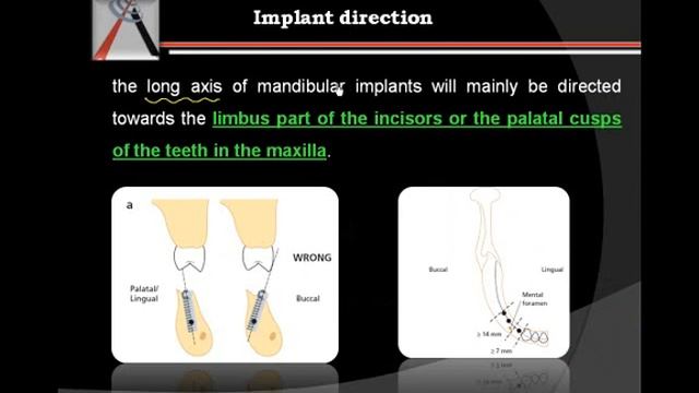 Dental implants смотреть онлайн