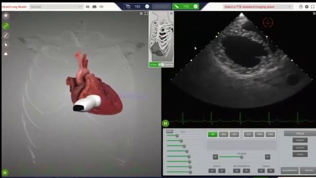 Focused Echo Training