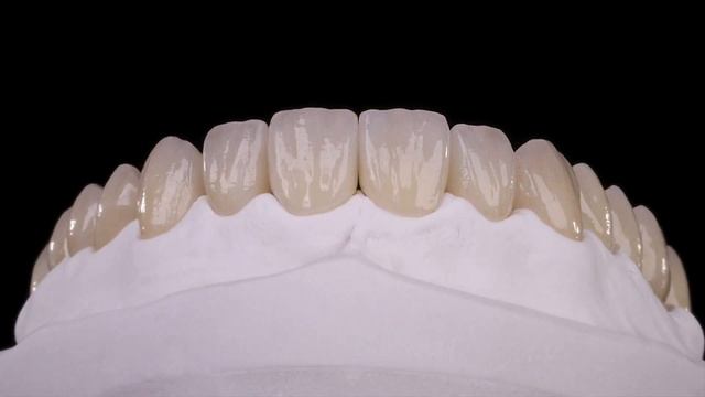 Complete restoration made with Prettau® 4 Anterior® zirconia | Zirkonzahn.Galleries смотреть онлайн