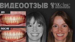 NKclinic - отзывы пациентов. Избавили от боли в челюсти без операции.