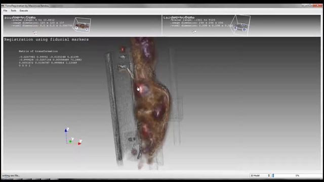 3D Image Registration & Surface Registration C++/Qt/VTK смотреть онлайн