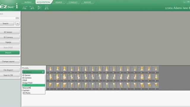 EZDent i, Chapter 02 2d Import CBCT Final смотреть онлайн