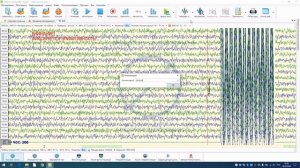Нейрон-Спектр.NET: Проведение типового обследования в программе