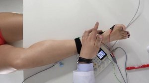 ЭМГ: Диагностика Повреждений Седалищного и Большеберцового Нервов