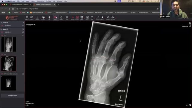 Monthly Case Webinar with Dr. Imran Lasker - #22 смотреть онлайн