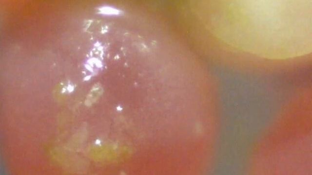 Mites (?) on Cana Apple Snail eggs смотреть онлайн