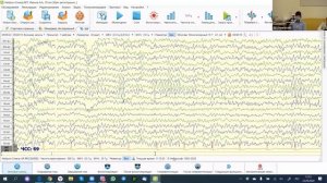 Порядок проведения рутинного ЭЭГ-обследования