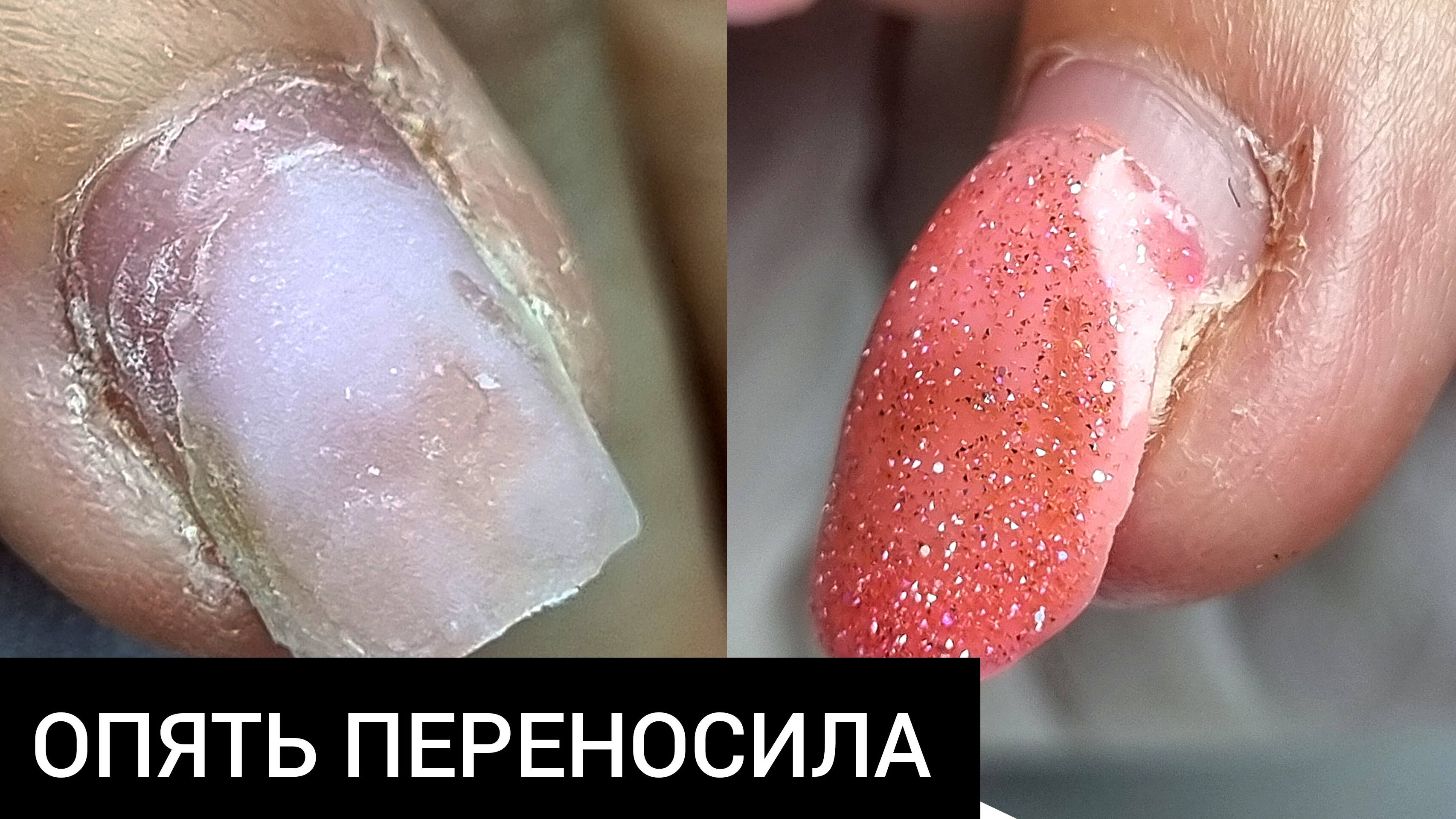 опять ПЕРЕНОСИЛА