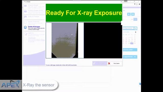 Apex Dental Sensors Work With iDentalSoft смотреть онлайн