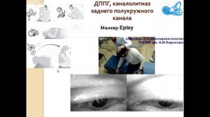 Доброкачественное пароксизмальное позиционное головокружение (ДППГ): диагностика и лечение