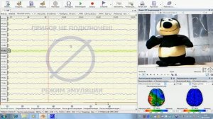 Нейрон-Спектр-NET: Видеомониторинг ЭЭГ
