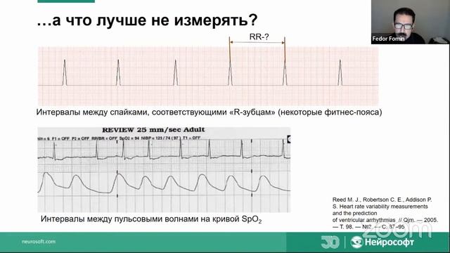 Физиологические основы феномена вариабельности сердечного ритма и подходы к ее анализу смотреть онлайн