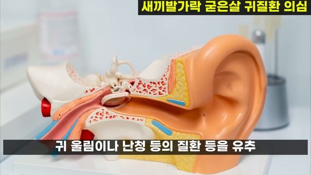 발바닥에 이것 있다면 치매가 온다는 신호. 당장 확인하세요. смотреть онлайн