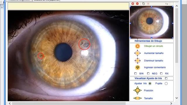 Software de Iridologia - AIGAL - Compatible con Windows 8 смотреть онлайн