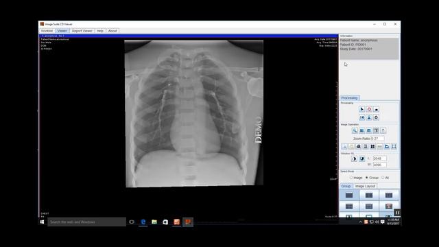 View Patient CD in ImageSuite смотреть онлайн