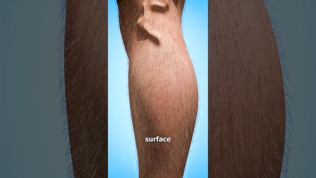 What Is A Guinea Worm? 😨 смотреть онлайн