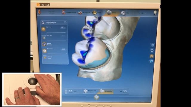 CEREC Dental Assistant Training - hands on crown design - setup through positioning смотреть онлайн
