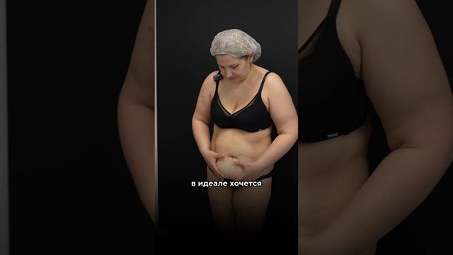 Бодилифт и Липосакция | История пациента смотреть онлайн