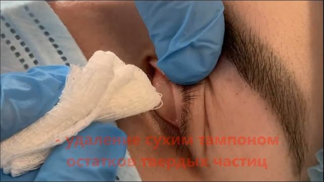 Первая помощь при ожогах глаз смотреть онлайн