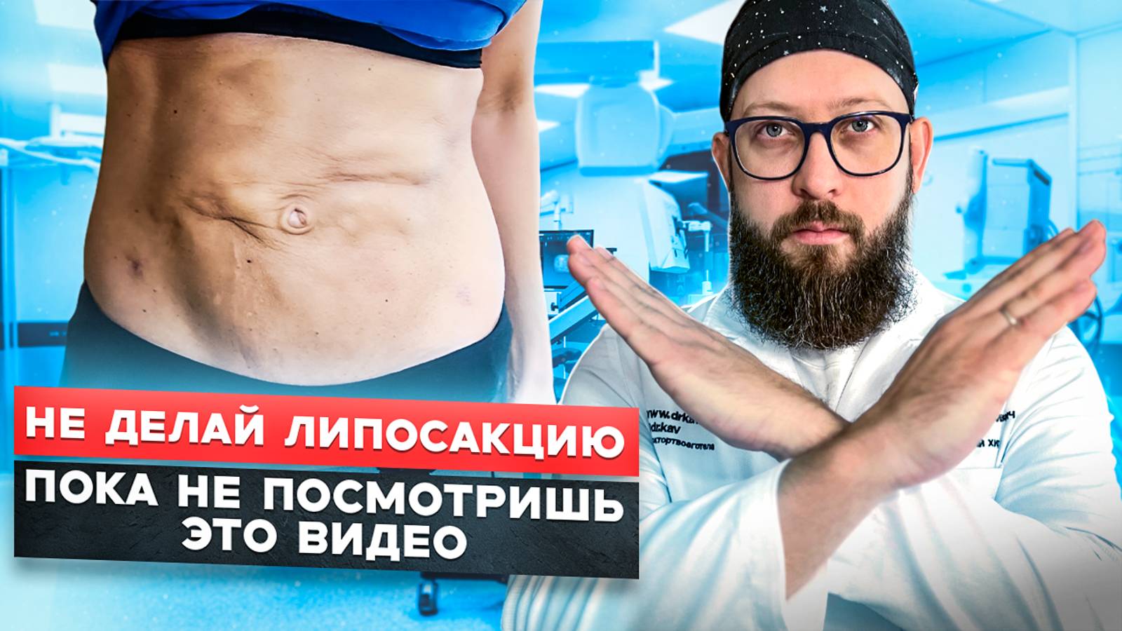 БУГРЫ после ЛИПОСАКЦИИ | Как их избежать? смотреть онлайн