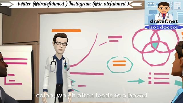 Cecal Volvulus / Causes / Pathology / Symptoms / Diagnosis / Treatment / Medical Lecture /No1docto смотреть онлайн