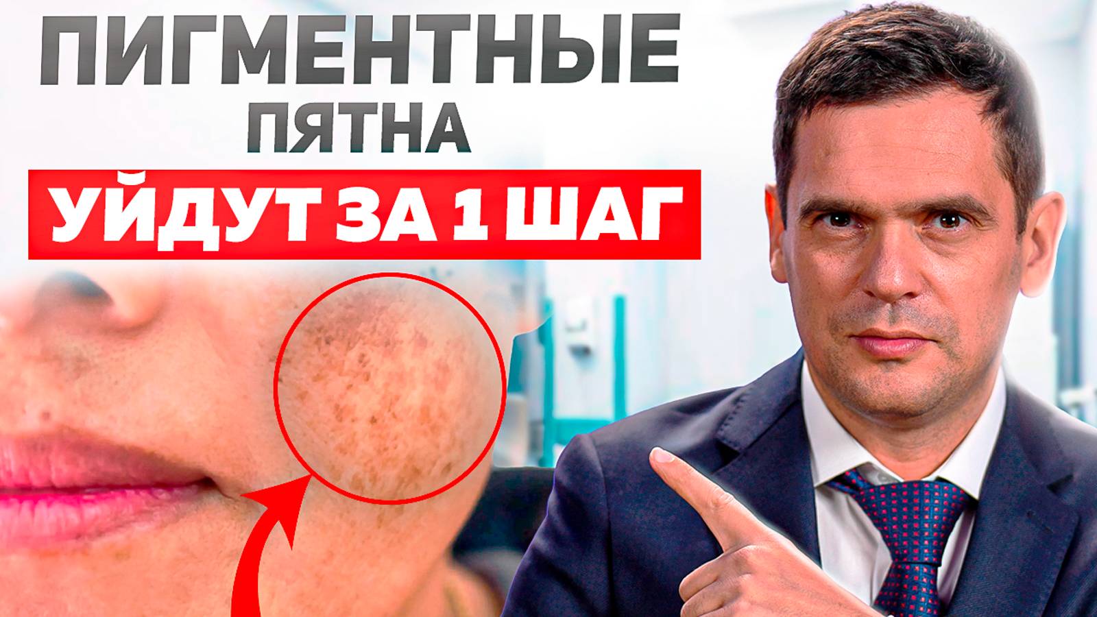 Главная Причина Пигментных Пятен и Кожных Заболеваний смотреть онлайн