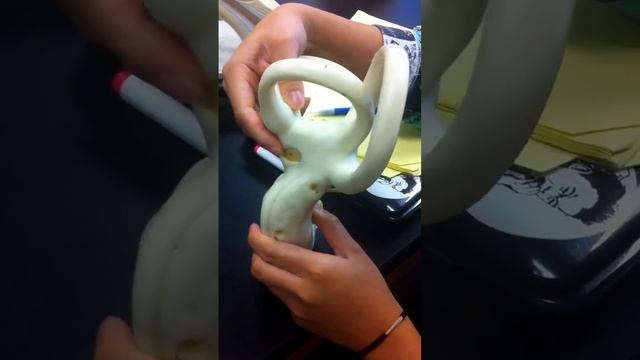 Inner Ear: oval window, round window, cochlea, vestibule смотреть онлайн