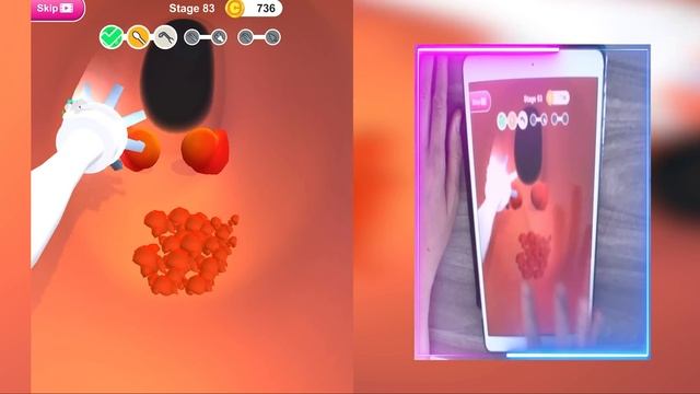 Earwax Clinic Game MAX LEVEL Mobile Video Games Android iOS XGGJF100 смотреть онлайн