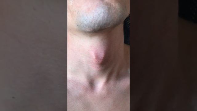 Adam's apple смотреть онлайн