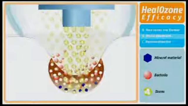 KaVo HealOzone смотреть онлайн