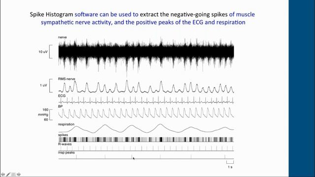 Webinar – Microneurography: Recording Nerve Traffic Via Intraneural Microelectrodes смотреть онлайн