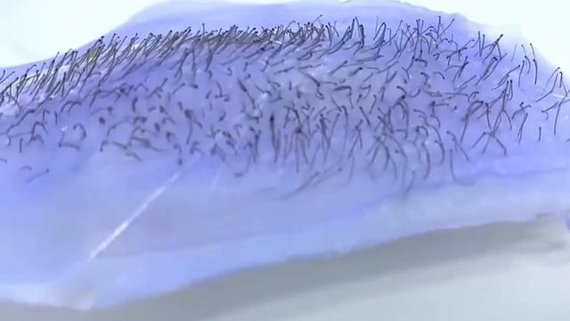 Идеальный срыв 😍
#лазернаяэпиляция #депиляция #электроэпиляция #косметология смотреть онлайн