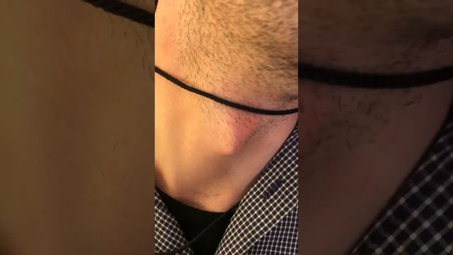 Adam's apple смотреть онлайн