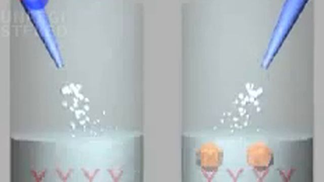ELISA KIT.wmv смотреть онлайн