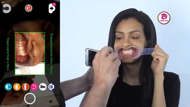 INTRAORAL como usar o afastador sem incomodar ou machucar os pacientes смотреть онлайн